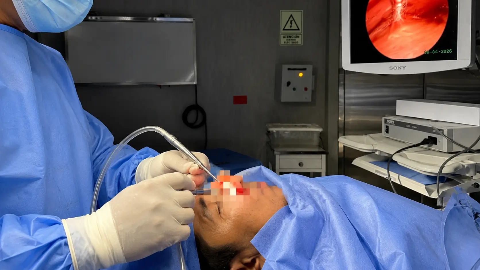 Dr. Freddy Castillo realizando una rinoplastia estructurada en su clínica de San Borja, Lima