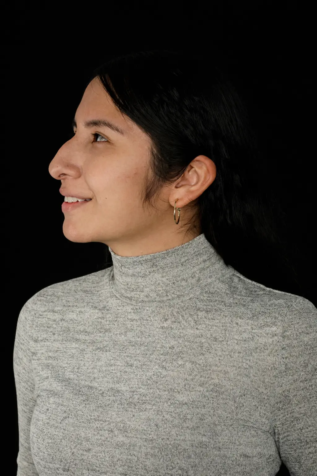 Perfil de paciente antes de la rinoplastia realizada por el Dr. Freddy Castillo en Lima