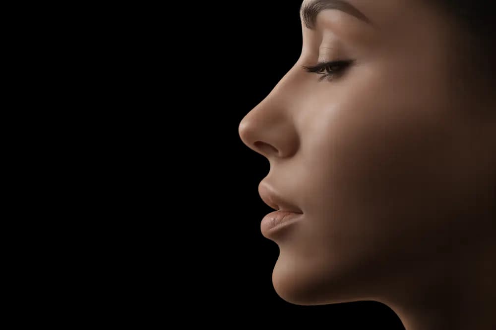 Rinoplastia — Cirugía de nariz que armoniza el rostro respetando la función respiratoria.