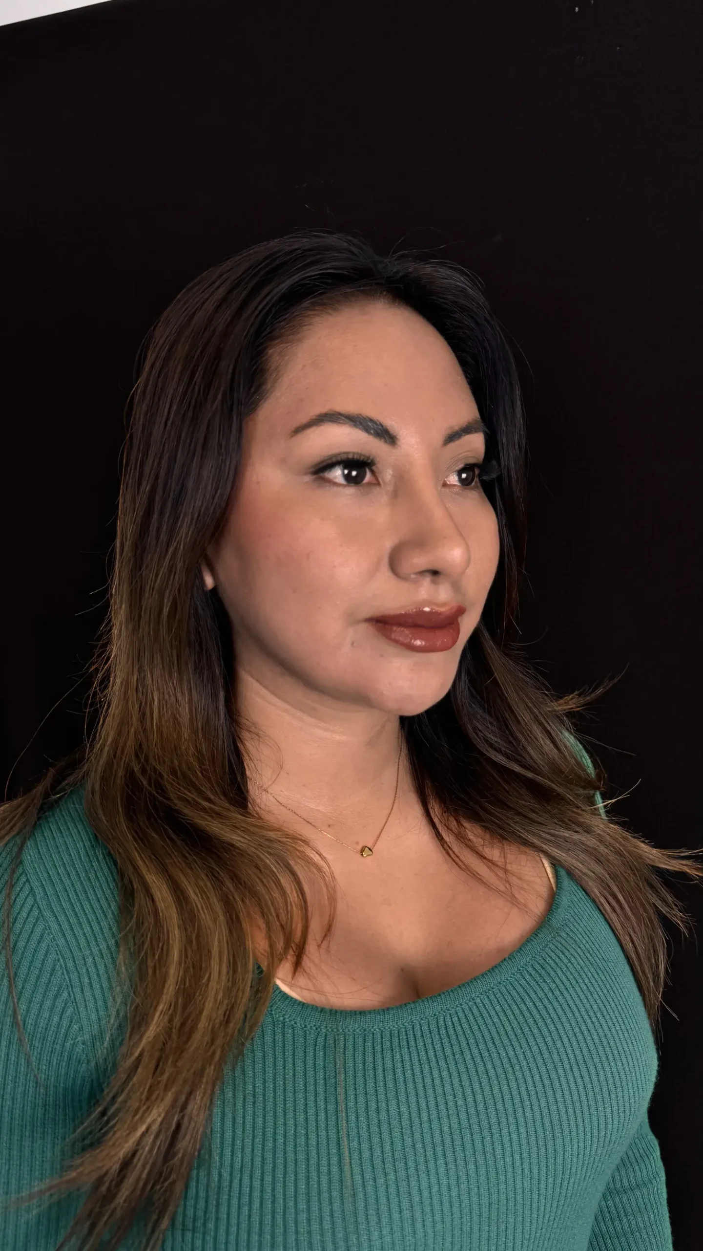 Después del lifting facial